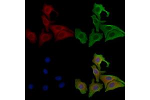 ABIN6257419 and ABIN6273804 staining Hela cells by IF/ICC. (PRKD3 抗体  (N-Term))