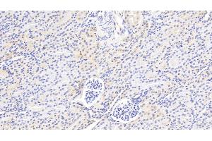 Detection of F2 in Rat Kidney Tissue using Polyclonal Antibody to Coagulation Factor II (F2) (Prothrombin 抗体  (AA 201-323))