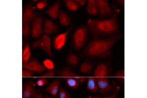 Immunofluorescence analysis of U2OS cells using PDLIM5 Polyclonal Antibody (PDLIM5 抗体)