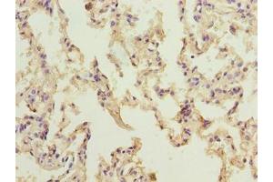 Immunohistochemistry of paraffin-embedded human lung tissue using ABIN7161614 at dilution of 1:100 (NINJ2 抗体  (AA 17-81))