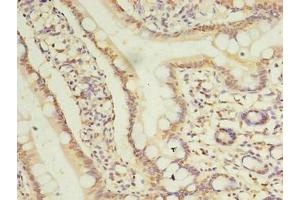 Immunohistochemistry of paraffin-embedded human small intestine tissue using ABIN7173421 at dilution of 1:100 (TRIM15 抗体  (AA 122-387))