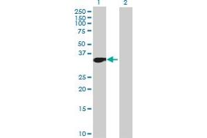 anti-Myeloid/lymphoid Or Mixed-lineage Leukemia, Translocated To, 6 (MLLT6) (AA 1-325) antibody