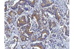 IHC analysis of HGS using anti-HGS antibody (ABIN7601207).
