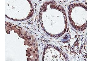 Immunohistochemistry (IHC) image for anti-Dual Specificity Phosphatase 23 (DUSP23) antibody (ABIN1497930) (DUSP23 抗体)