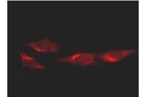 Immunofluorescence (IF) image for anti-Tumor Protein P53 (TP53) antibody (ABIN105263)