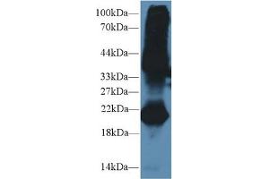 Western blot analysis of Mouse Testis lysate, using Mouse GREM1 Antibody (2 µg/ml) and HRP-conjugated Goat Anti-Rabbit antibody ( (GREM1 抗体  (AA 25-184))