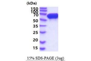 SDS-PAGE (SDS) image for Stress-Induced-phosphoprotein 1 (STIP1) (AA 1-543) protein (His tag) (ABIN5854815) (STIP1 Protein (AA 1-543) (His tag))