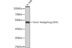 Western blot analysis of extracts of A-549 cells, using Sonic Hedgehog (Sonic Hedgehog (Shh)) antibody  at 1:1000 dilution. (Sonic Hedgehog 抗体)