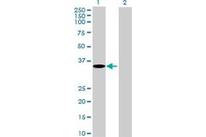 Western Blotting (WB) image for anti-G Protein-Coupled Receptor, Family C, Group 5, Member A (GPRC5A) (AA 1-357) antibody (ABIN522489)
