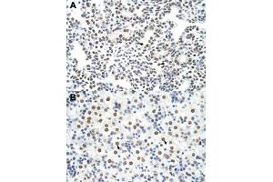 Immunohistochemical staining (Formalin-fixed paraffin-embedded sections) of human lung (A) and human liver (B) with HNRNPA3 polyclonal antibody  at 4-8 ug/mL working concentration. (HNRNPA3 抗体  (N-Term))
