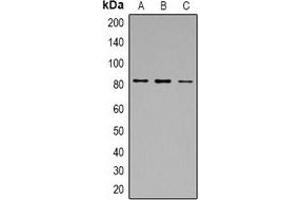 Western blot analysis of Calpain 1 expression in A549 (A), MCF7 (B), Jurkat (C) whole cell lysates.