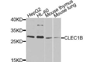Western blot analysis of extracts of various cells, using CLEC1B antibody. (C-Type Lectin Domain Family 1, Member B (CLEC1B) 抗体)