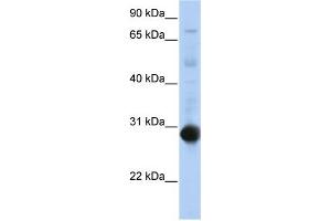 WB Suggested Anti-NR0B2 Antibody Titration:  0. (NR0B2 抗体  (Middle Region))
