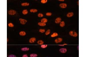 Immunofluorescence analysis of C6 cells using MYEF2 Polyclonal Antibody at dilution of 1:100. (MYEF2 抗体)