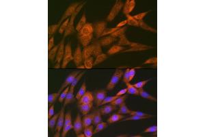 Immunofluorescence analysis of NIH-3T3 cells using 14-3-3 Theta Rabbit mAb (ABIN7265312) at dilution of 1:100 (40x lens). (14-3-3 theta 抗体)