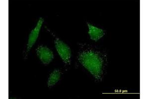 Immunofluorescence of purified MaxPab antibody to ACOT8 on HeLa cell. (ACOT8 抗体  (AA 1-319))
