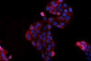 IF analysis of BAG2 using anti-BAG2 antibody (ABIN3043508). (BAG2 抗体  (AA 1-211))