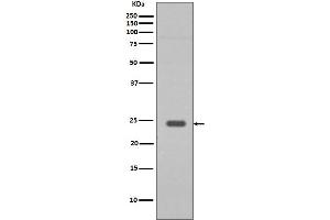 Western blot analysis of Rab9 expression in HepG2 cell lysate. (Recombinant RAB9A 抗体)