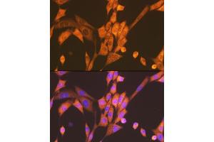 Immunofluorescence (IF) image for anti-Regulatory Associated Protein of mTOR, Complex 1 (RPTOR) antibody (ABIN7269900)