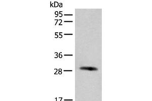 Western blot analysis of Human urinary bladder tissue lysate using CFHR2 Polyclonal Antibody at dilution of 1:550 (CFHR2 抗体)