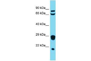 Western Blotting (WB) image for anti-Mitochondrial Ribosomal Protein L18 (MRPL18) (N-Term) antibody (ABIN2791669)