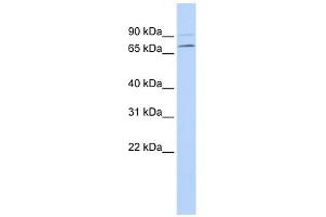 YTHDF3 antibody used at 1 ug/ml to detect target protein. (YTHDF3 抗体  (N-Term))