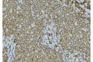 ABIN6273029 at 1/100 staining Mouse kidney tissue by IHC-P. (ACADS 抗体)