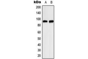 Western blot analysis of ITPKC expression in HeLa (A), RT4 (B) whole cell lysates. (ITPKC 抗体  (Center))