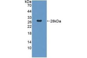 Detection of Recombinant GbL, Human using Polyclonal Antibody to G Protein Beta Subunit Like Protein (GbL) (GNB1L 抗体  (AA 69-247))