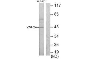 Western blot analysis of extracts from HUVEC cells, using ZNF24 antibody. (ZNF24 抗体  (N-Term))
