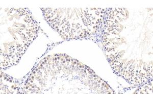 Immunohistochemistry (IHC) image for anti-Peptidylprolyl Isomerase A (Cyclophilin A) (PPIA) (AA 2-164) antibody (ABIN7432967)