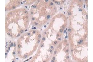 Immunohistochemistry (IHC) image for anti-Proteasome (Prosome, Macropain) 26S Subunit, Non-ATPase, 2 (PSMD2) (AA 645-872) antibody (ABIN7439738)