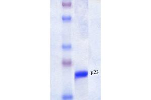 SDS-PAGE of native human 23 kDa p23 protein (ABIN1686720, ABIN1686721 and ABIN1686722). (CDK5R1 蛋白)