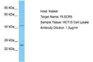 Host: Rabbit Target Name: PLSCR5 Sample Type: HCT15 Whole Cell lysates Antibody Dilution: 1. (PLSCR5 抗体  (C-Term))