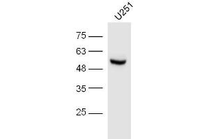 U251 lysates probed with IRF3 (Ser396) Polyclonal Antibody, unconjugated  at 1:300 overnight at 4°C followed by a conjugated secondary antibody at 1:10000 for 60 minutes at 37°C. (IRF3 抗体  (pSer396))