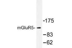 Image no. 1 for anti-Glutamate Receptor, Metabotropic 5 (GRM5) antibody (ABIN317705) (Metabotropic Glutamate Receptor 5 抗体)