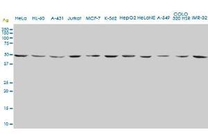 ENO2 monoclonal antibody (M01), clone 1A3. (ENO2/NSE 抗体  (AA 325-434))