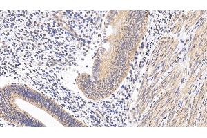 Immunohistochemistry (IHC) image for anti-Mitogen-Activated Protein Kinase 14 (MAPK14) (AA 19-279) antibody (ABIN7433252)