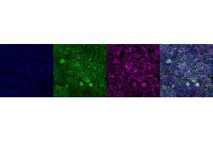 Immunohistochemistry (IHC) image for anti-Tryptophan Hydroxylase 2 (TPH2) antibody (ABIN7456102) (Tryptophan Hydroxylase 2 抗体)
