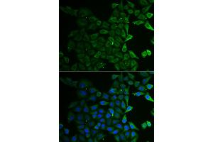 Immunofluorescence analysis of HeLa cells using C21orf33 antibody. (C21orf33 抗体)