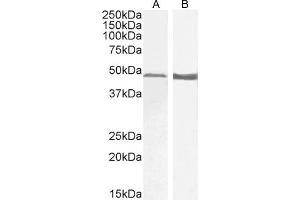 Western Blotting (WB) image for anti-Glial Fibrillary Acidic Protein (GFAP) (C-Term) antibody (ABIN185730)
