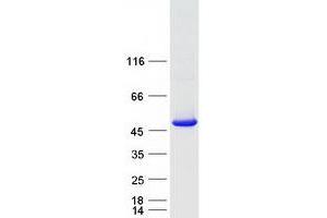 Western Blotting (WB) image for TBC1 Domain Family, Member 13 (TBC1D13) protein (Myc-DYKDDDDK Tag) (ABIN2733258)