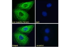 ABIN185279 Immunofluorescence analysis of paraformaldehyde fixed HeLa cells, permeabilized with 0. (TXNDC5 抗体  (C-Term))