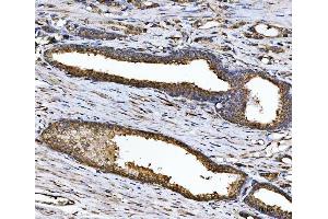 IHC analysis of CHM using anti-CHM antibody (ABIN6719537).