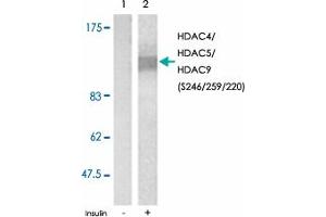 Western blot analysis of extracts from NIH/3T3 cell using HDAC4/HDAC5/HDAC9 (phospho S246/259/220) polyclonal antibody . (HDAC4 抗体  (pSer220, pSer246, pSer259))