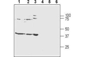 Western blot analysis of rat brain membranes (lanes 1 and 4), mouse brain membranes (lanes 2 and 5) and human SH-SY5Y neuroblastoma cell lysates (lanes 3 and 6): - 1-3. (KCNJ10 抗体  (C-Term, Intracellular))