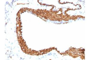 Immunohistochemistry (IHC) image for anti-Actin, alpha 2, Smooth Muscle, Aorta (ACTA2) (N-Term) antibody (ABIN6940521)