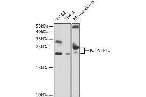 Western blot analysis of extracts of various cell lines, using TCTP/TCTP/TPT1 antibody  at 1:1000 dilution. (TPT1 抗体  (AA 1-172))