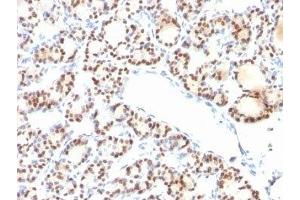 Formalin-fixed, paraffin-embedded human thyroid stained with TTF1 antibody (NX2. (TTF1 抗体)