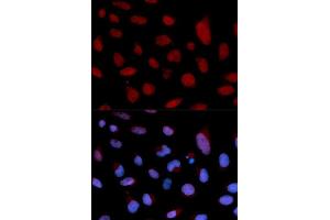 Immunofluorescence (IF) image for anti-Cardiac Troponin C (TNNC1) (AA 1-160) antibody (ABIN3015719) (TNNC1 抗体  (AA 1-160))